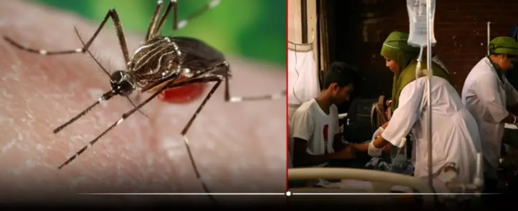dengue feve