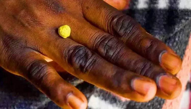 Gold Mine Collapse My News Bangladesh